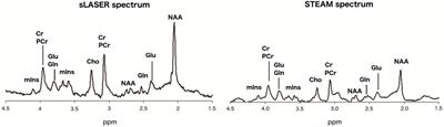 Detection of Glutamate Alterations in the Human Brain Using 1H-MRS: Comparison of STEAM and sLASER at 7 T